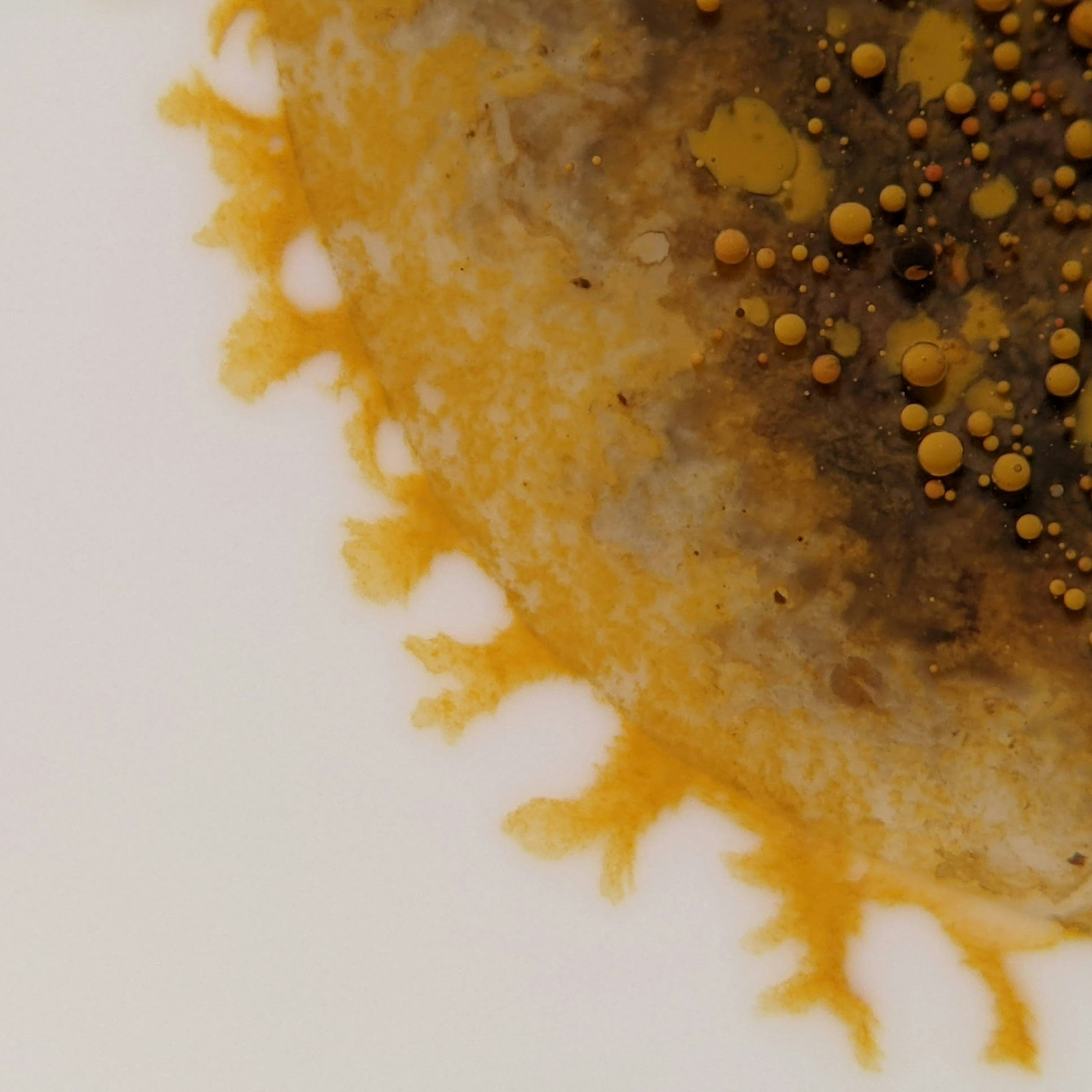 Oral Microbiome Test